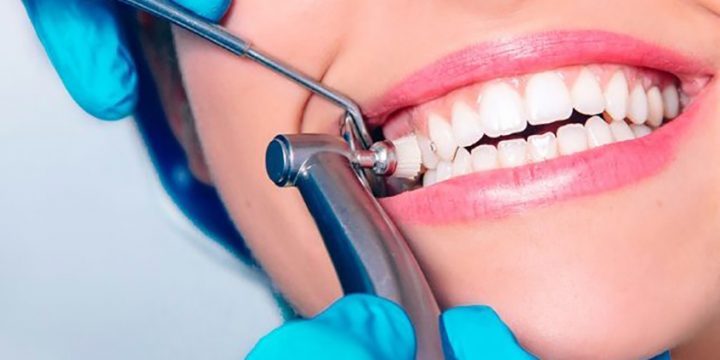 High quality crowns bridges dental services Beckenham