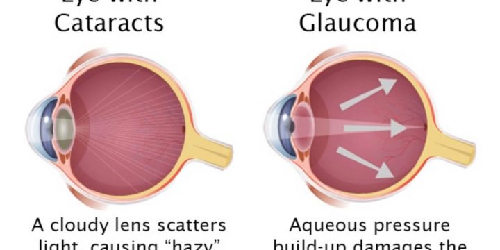 Top Rated Medical and Eye Check-ups in Turkey: Types and Prices in Istanbul and Antalya